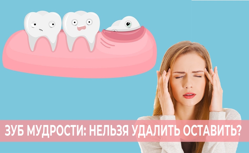 Энциклопедия медицины: нужно ли удалять зубы мудрости?
